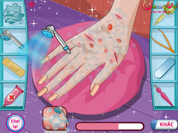 Màn hình chơi game Anna chữa thương tay